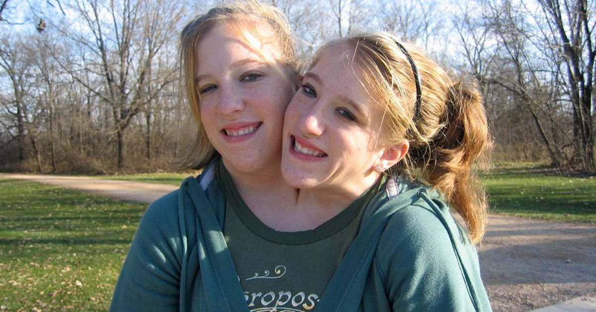 What Conjoined Twins Abby And Brittany Hensel Look Like Now - Jesus Daily