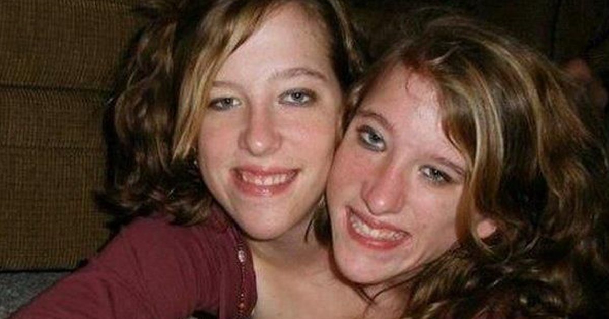 Conjoined Twins Abby And Brittany Hensel Are Now Thriving 30 Years Later