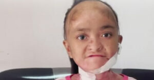 What Conjoined Twins Abby And Brittany Hensel Look Like Now - Jesus Daily