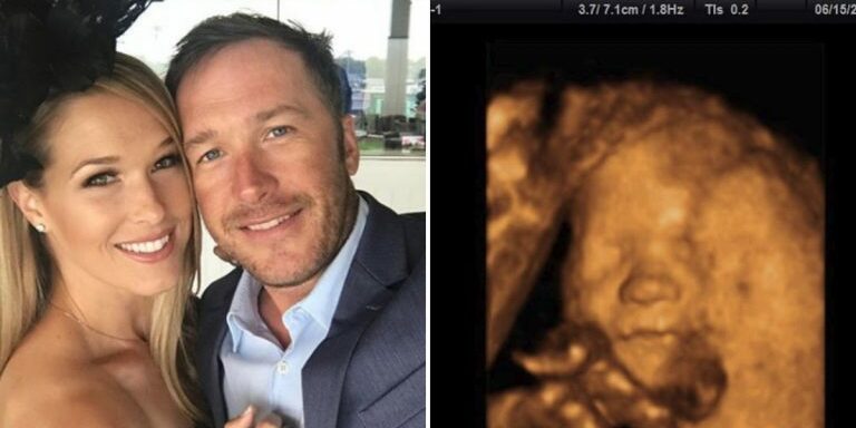 Bode-Miller-Ultrasound