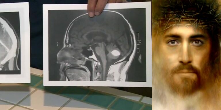 braintumor-jesus