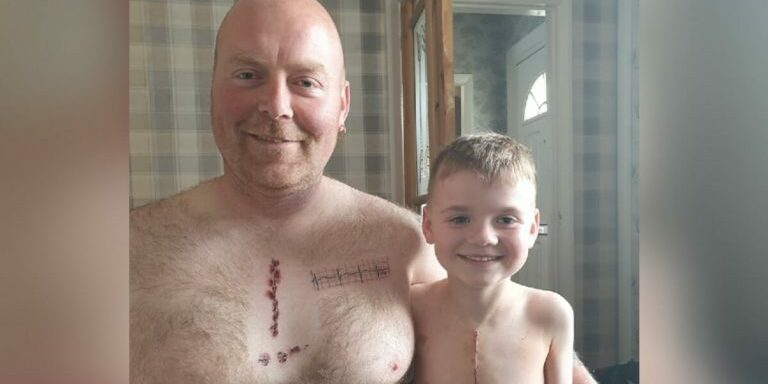 dad-gets-tattoo-to-match-scar