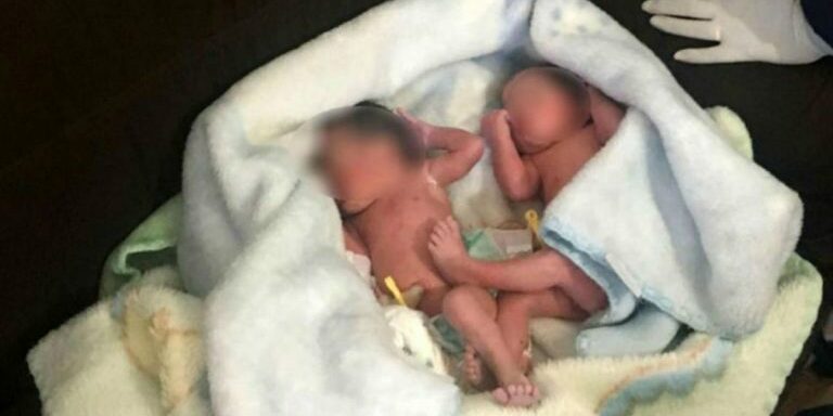 twins-found-in-bush-in-brazil-fb