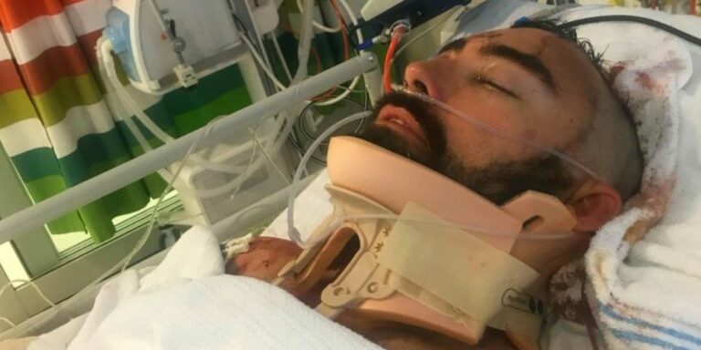 heroic-dads-balcony-fall-to-save-son-fb