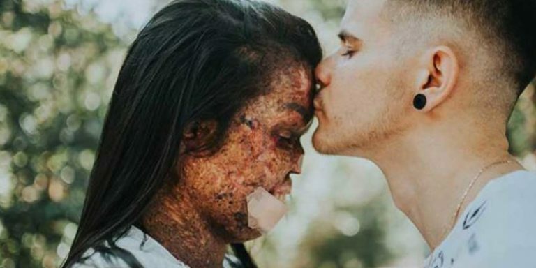 man-of-god-engaged-to-woman-diagnosed-with-incurable-skin-disease-and-inspires-millions-1-800x600
