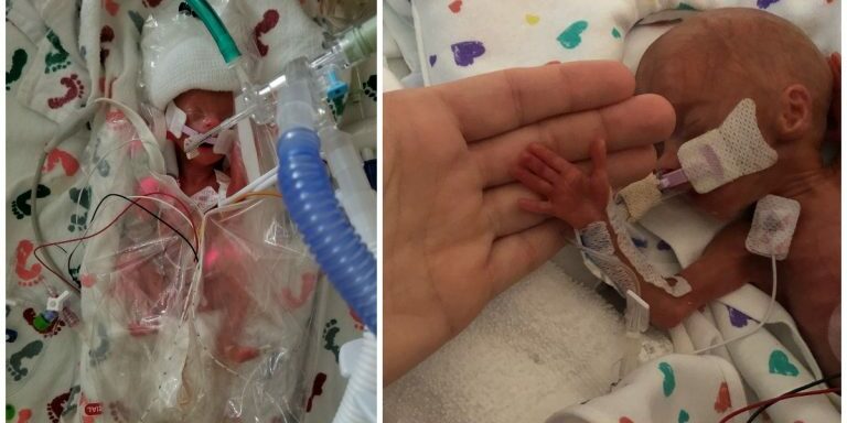 micro-preemie
