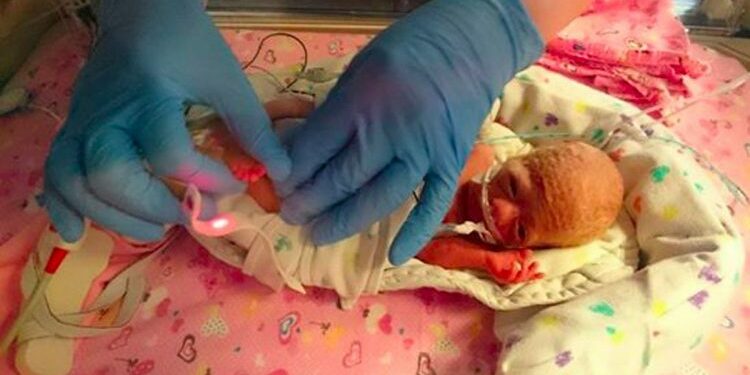 premature-baby-feat-750x393