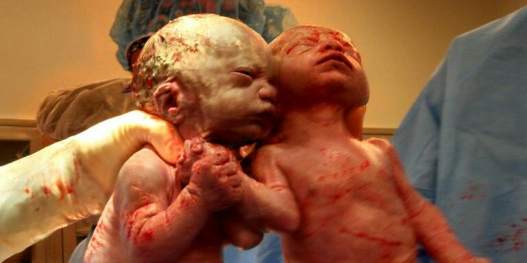 twins_holding_hands